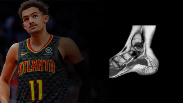 atlanta-hawks-await-mri-on-trae-young’s-ankle-but-x-rays-show-no-damage